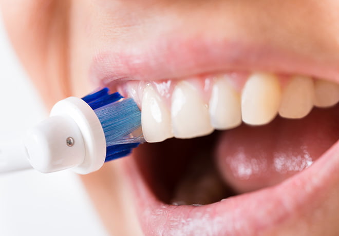 PMTCで徹底的な歯のクリーニングを　イメージ画像