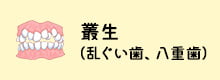 叢生（乱ぐい歯、八重歯）