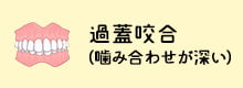 過蓋咬合（噛み合わせが深い）